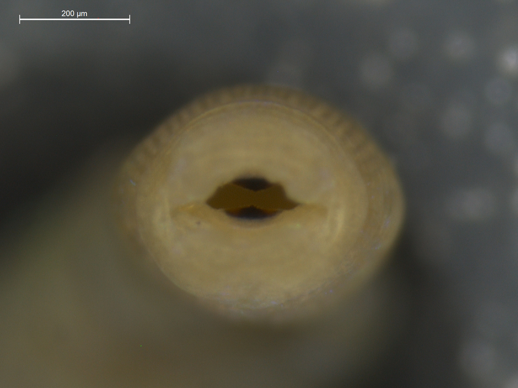 Branchiobdella parasita